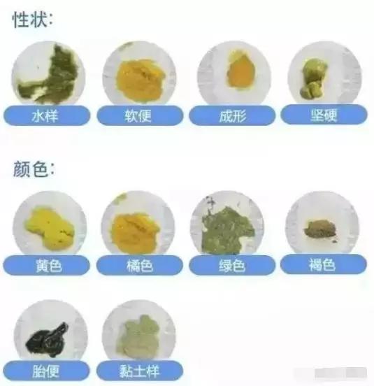 恰十年：如果宝宝大便出现了这种颜色，可能是过度喂养了...