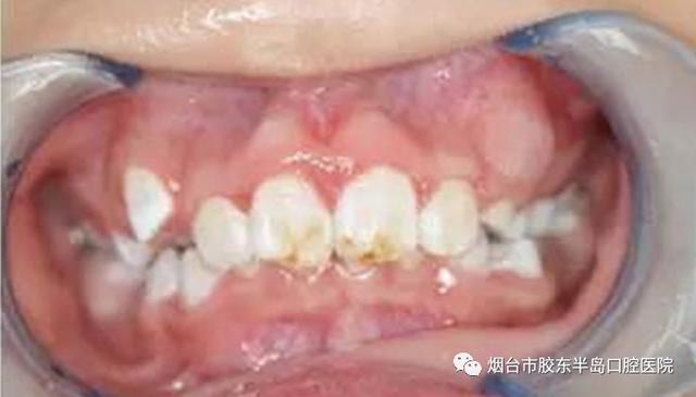 #你的育儿经#孩子不懂大人不在乎 有可能会影响孩子一生