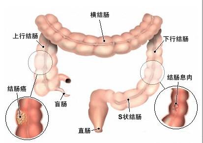 排毒|肠道需要经常“排毒”？肠好人才好，坚持7件事助您靠谱保护肠道