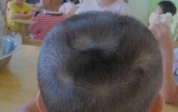 #超级宝妈#“一旋好二旋拧三旋敢与火车碰”孩子旋多好？旋少好？父母要知道