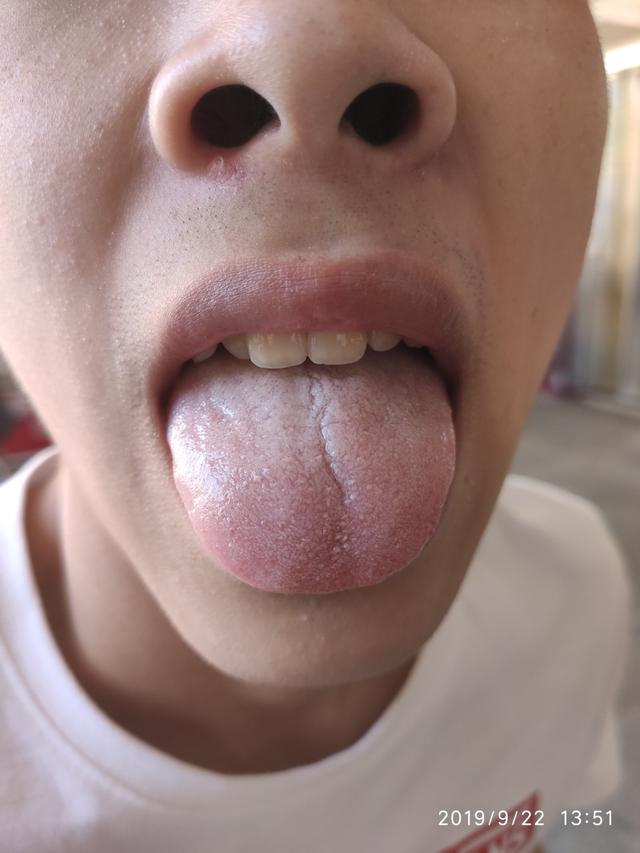 [你的育儿经]你的脾胃健康吗？