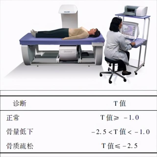 骨质疏松症的新型疗法——合成代谢药物