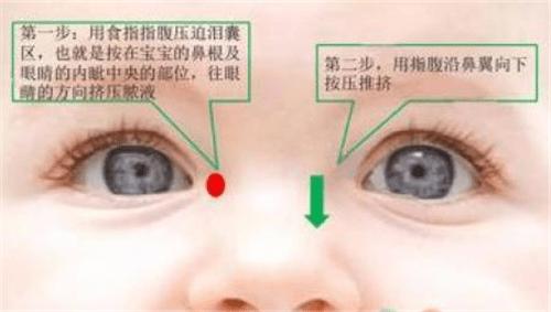 『你的育儿经』宝宝眼泪多、眼部分泌物多、眼周湿疹，如何轻松在家搞定