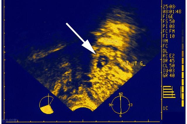 我们都是好孩子|来让我告诉你，输卵管不通怎么怀孕