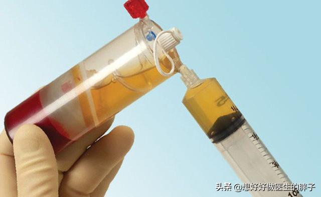 上下楼膝盖疼，平路没事，可能有髌骨软骨软化，医生教您一招自检