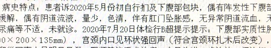 女人有这6个特征，或已成为卵巢癌“候选人”，别以为是月经不调