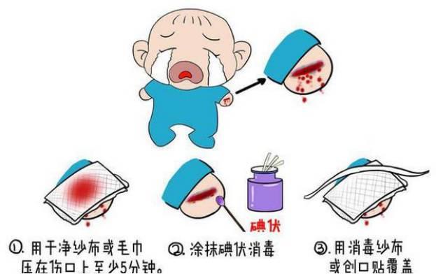 「你的育儿经」宝宝磕破皮，这3件事做不好，后果很严重