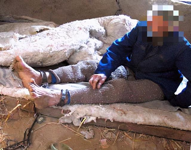 孤僻懒散的阴性症状，比幻觉、妄想更顽固，医生教你如何应对