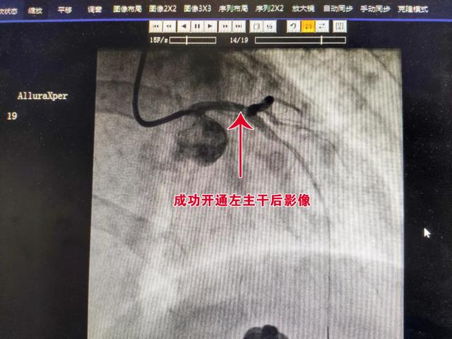 滨州市中心医院正式获得“中国胸痛中心”授牌