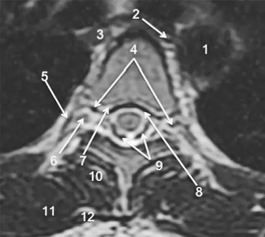 ռ׵ MRI ͼ