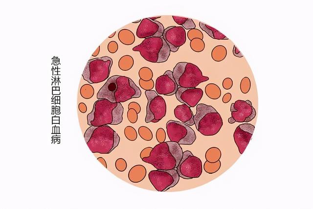 白血病患者，用化疗药物时，有啥需要注意的？医生给出诚心建议