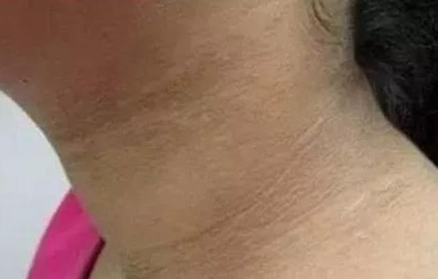 你的育儿经@9岁女孩脖子黑洗不掉，检查后医生这样说，父母听后哭笑不得
