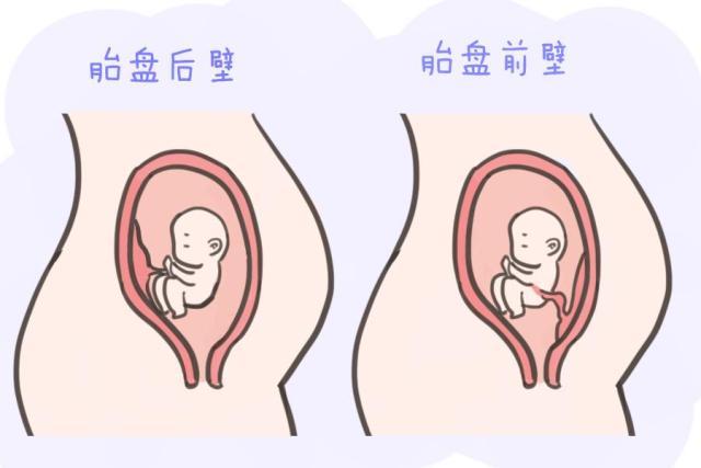 你的育儿经|胎盘在子宫安家，常选三个地方：前壁、后壁和下段，最后一个危险