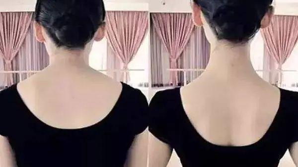 带货女王背部减肥体式交给你，练完穿上小吊带，“蝴蝶骨”清晰可见好迷人