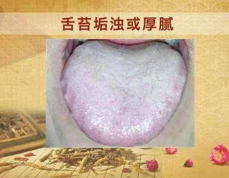 【辟谣】薏仁绿豆粥，真的能祛湿吗？