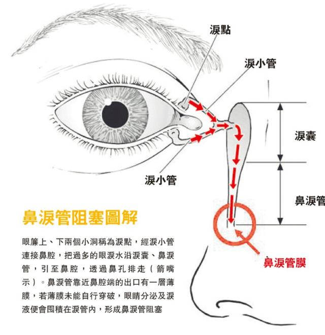 『你的育儿经』宝宝眼泪多、眼部分泌物多、眼周湿疹，如何轻松在家搞定