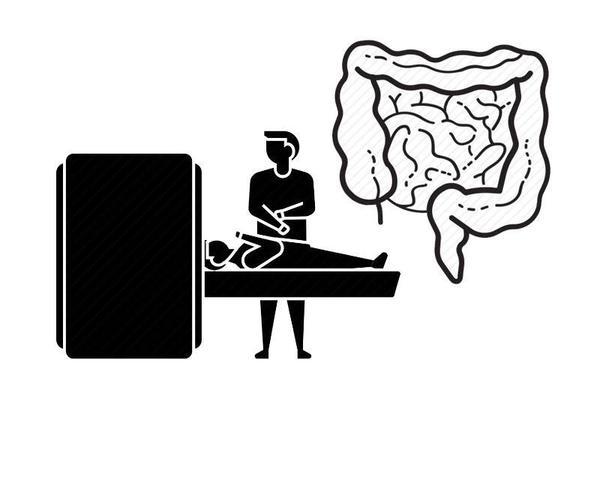 肠癌引起的腹痛在哪个位置？与普通腹痛有区别吗？医生一文解释清