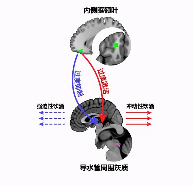 酒精|青少年为何会酗酒？复旦大学团队合作提出酗酒行为成因新机制