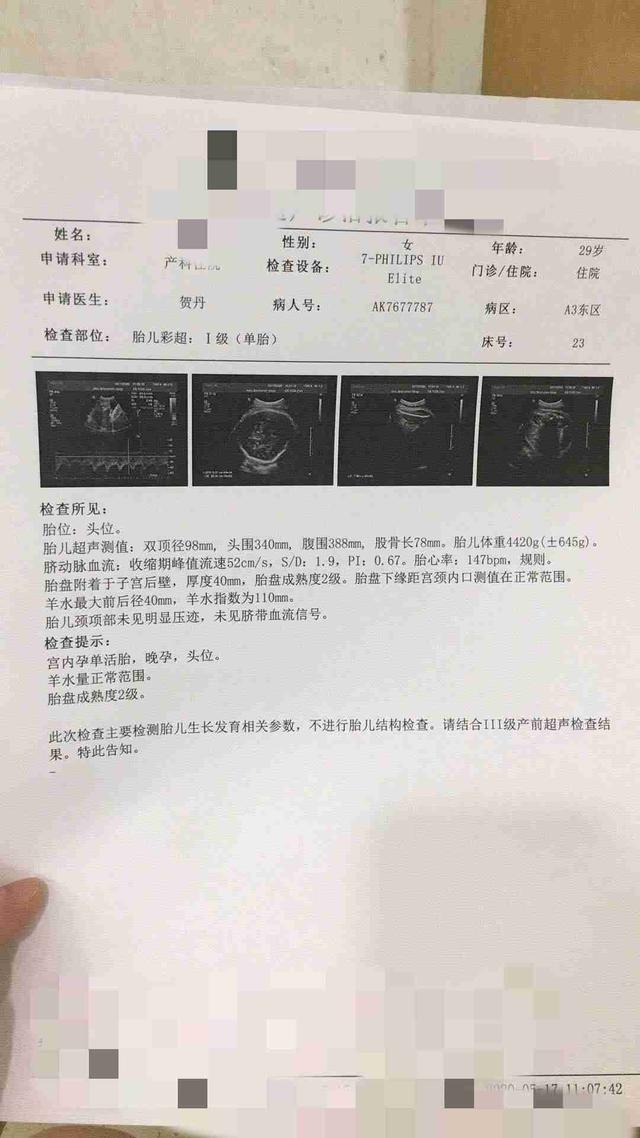 你的育儿经|剖腹产好还是顺产好？别再争了！妇产科医生给了一个准答案