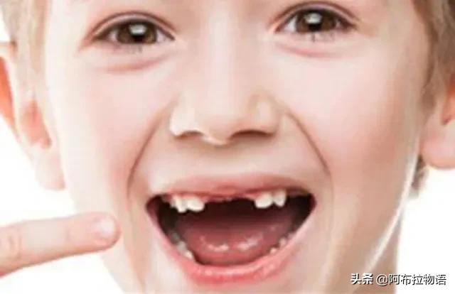 「超级宝妈」父母别扔掉孩子的乳牙，关键时刻能救孩子一命，是真的吗？