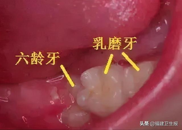 壮壮|宁德13岁男孩不愿意吃饭，一查牙齿惊呆！医生：这种想法，错误