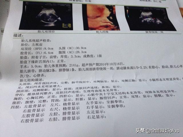 一个小心愿|“多喝水”羊水就不会偏低？不一定，这3种“信号”孕妈要警惕