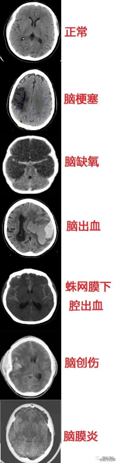 WoW，最全神经系统解剖图来了