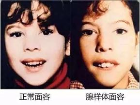 [你的育儿经]宝宝睡觉打鼾？张嘴呼吸？别以为这不是事！