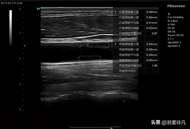 海信入局高端医疗设备领域，首款超声产品发布，9项优势行业领先