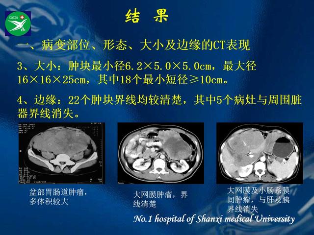 李健丁教授：胃肠道外间质瘤的CT表现和临床病理分析