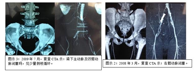 患者|这个症状，平均5人里面就有1人在患，医生提醒：鉴别诊断很重要！