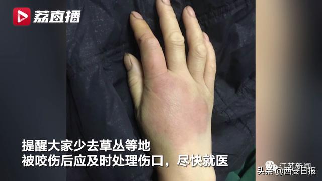 蜈蚣|被这种虫子咬一口，女子窒息身亡！被咬后千万别这样做
