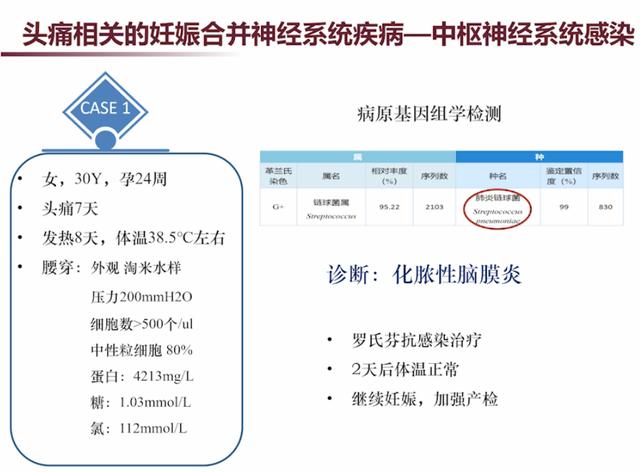 「超级宝妈」张馨：3类需要注意的妊娠合并神经系统疾病