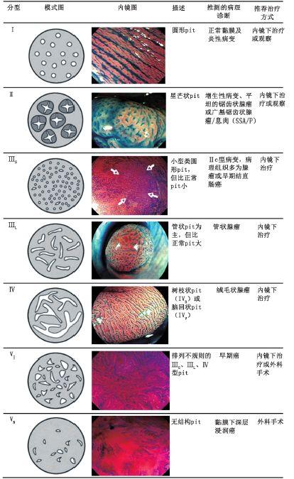 内痔|便中带血就是痔？注意区分癌和痔