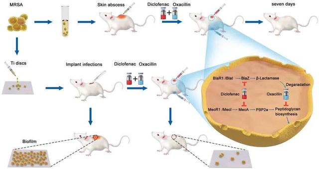 骨关节|谁说传统药物没效果？仁济医院团队发现其对抗超级耐药菌“有一套”