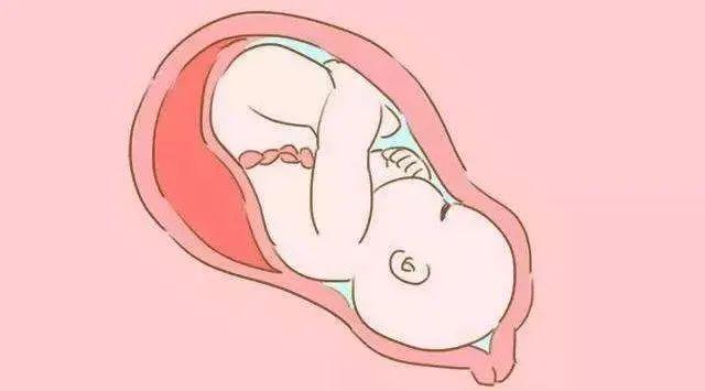 超级宝妈|调皮的宝宝把自己绕进去了怎么办？#健康科普排位赛#