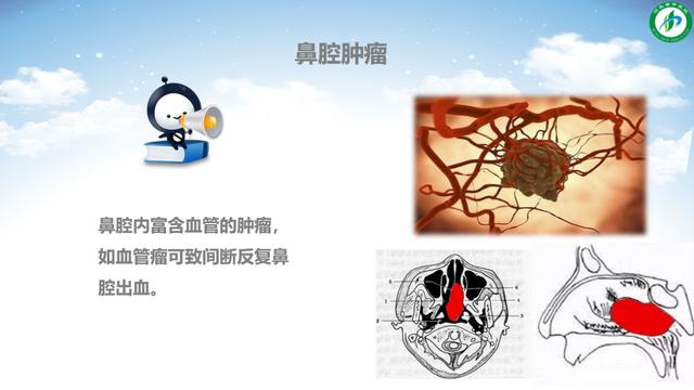 【你的育儿经】宝宝流鼻血？可能是这几个原因造成的！别不当回事儿