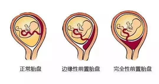 你的育儿经|好闺蜜怀孕快10周了，今天她突然问我，宝宝是生活在胎盘里面吗？