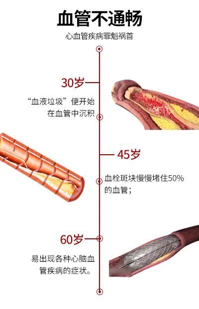 红曲米|护血管只知道吃三七？天然“血管清道夫”，中医常用它泡水喝