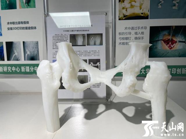 打印|新疆建立医学3D打印创新研究中心