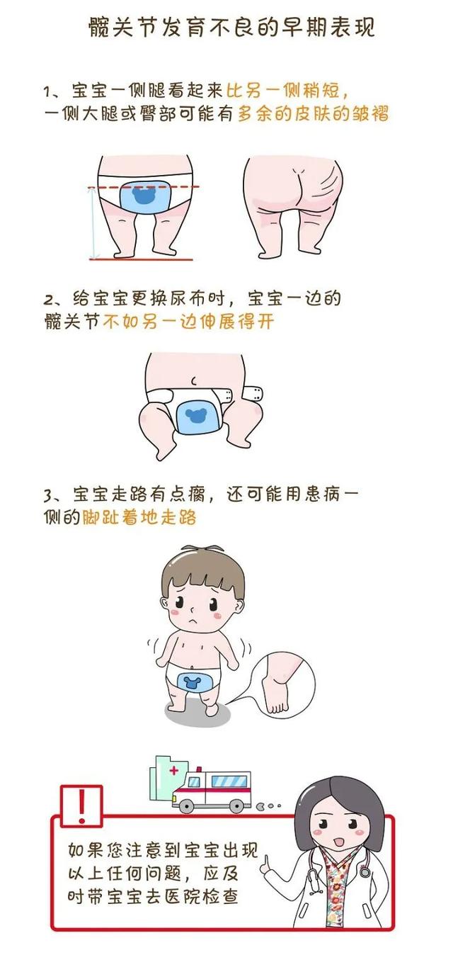 超级宝妈|平泉市医院成功开展婴幼儿髋关节超声检查