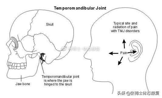 「译文分享」头颈姿势与颞下颌关节疼痛的关系