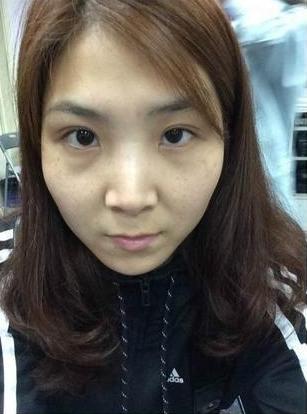 超级宝妈■来自湖南的王女士，从25岁怀孕时就开始长斑，现在斑已经没有了