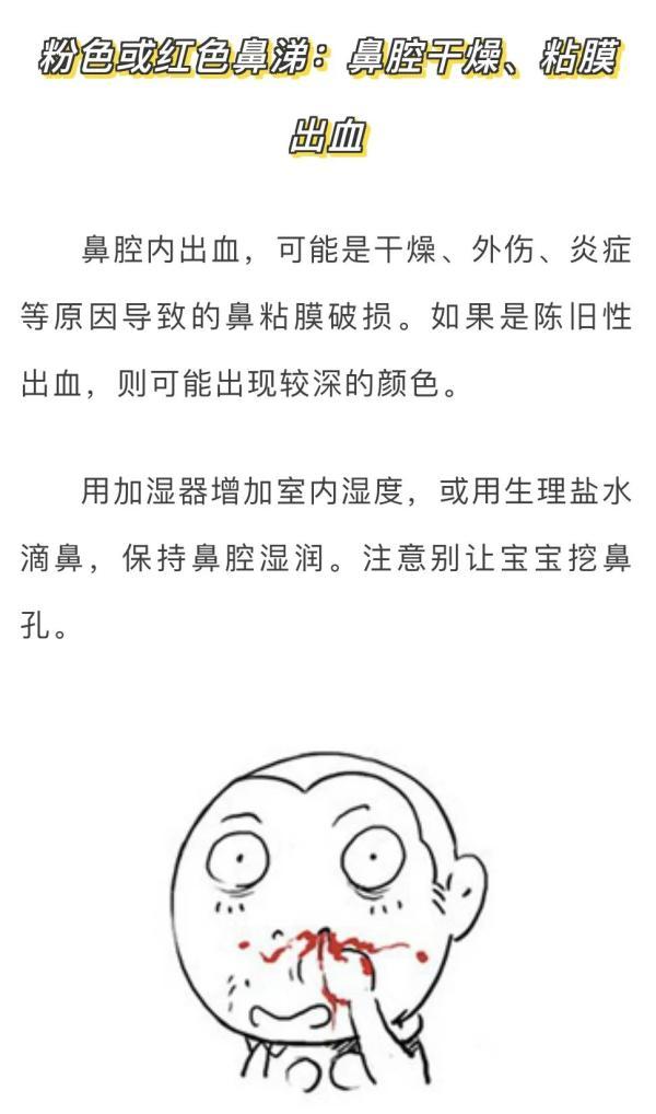 光明网@注意：鼻涕≠感冒，流这种鼻涕，要警惕