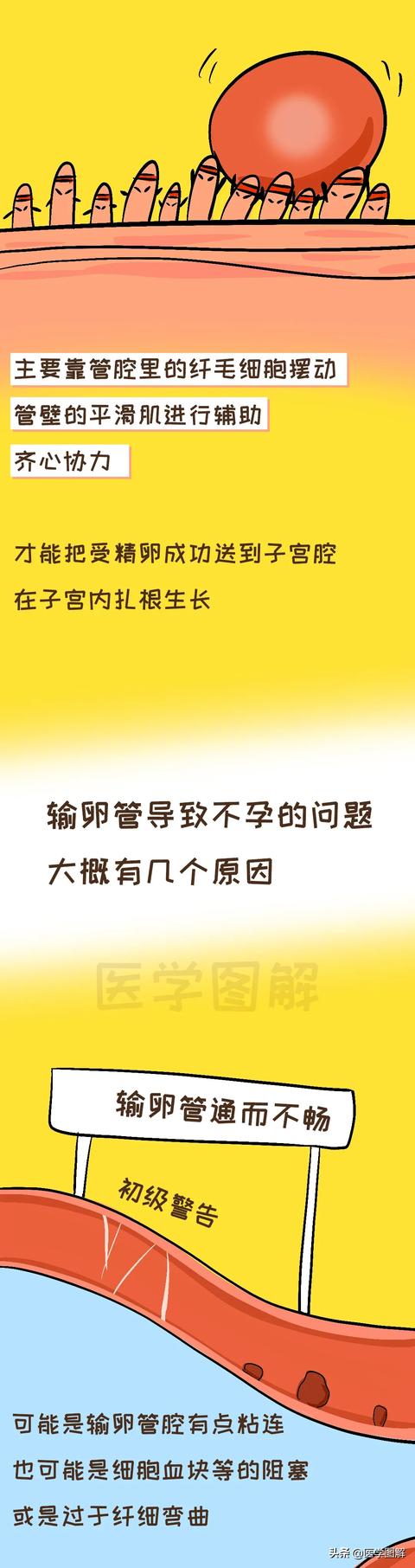 超级宝妈■女性怀孕的重要通道，不孕可能来自这里丨医学图解