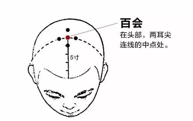 睡眠不好原因多 中医手把手教你调理