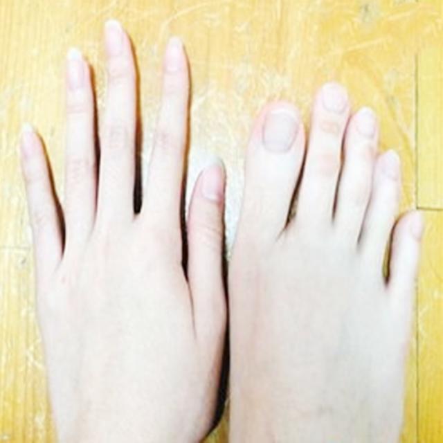 「超级宝妈」孩子腿部如果有两个“特征,”以后可能是高个子,你家孩子有没?