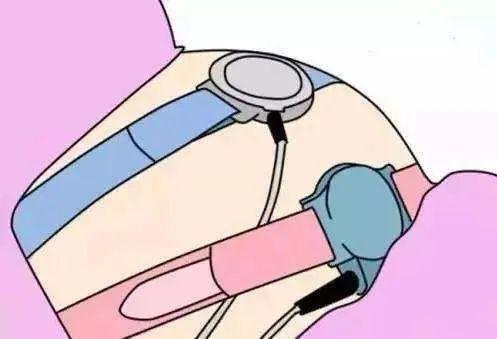 亲情家族|胎心监护不过关是宝宝有问题吗？