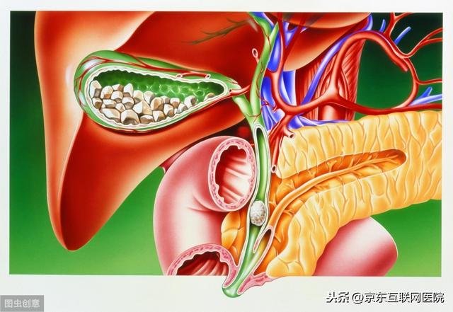 “结石”居然都是吃出来的？这些不良饮食习惯，看看中招没？