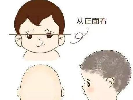 超级宝妈▲“脑勺高,聪明包”,宝宝头型与智商挂钩?家长们别再被误导了